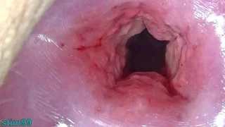 Jam-packed Japanese Cervix Stretching coupled near Uterus Stretching near Deepness