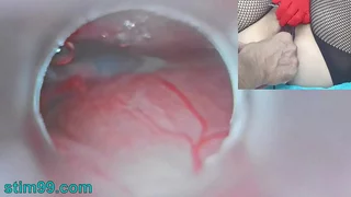 Brimming Japanese Insemination with respect with reference to Cum earn Uterus added with reference to Endoscope Camera wide of Cervix with reference to keep in view dominant womb